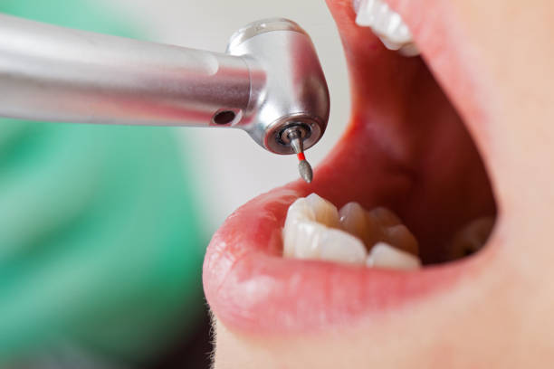 Best Broken or Cracked Tooth Emergency Dentist in Yorkshire, VA